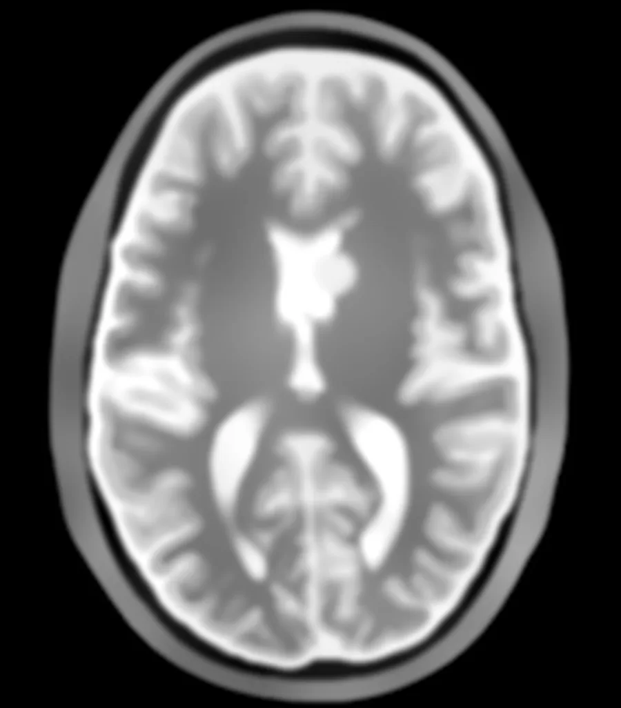 Tomographic image